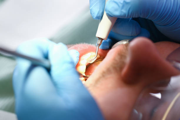 Best Emergency Treatment for Oral Infections in Mount Pleasant, TN